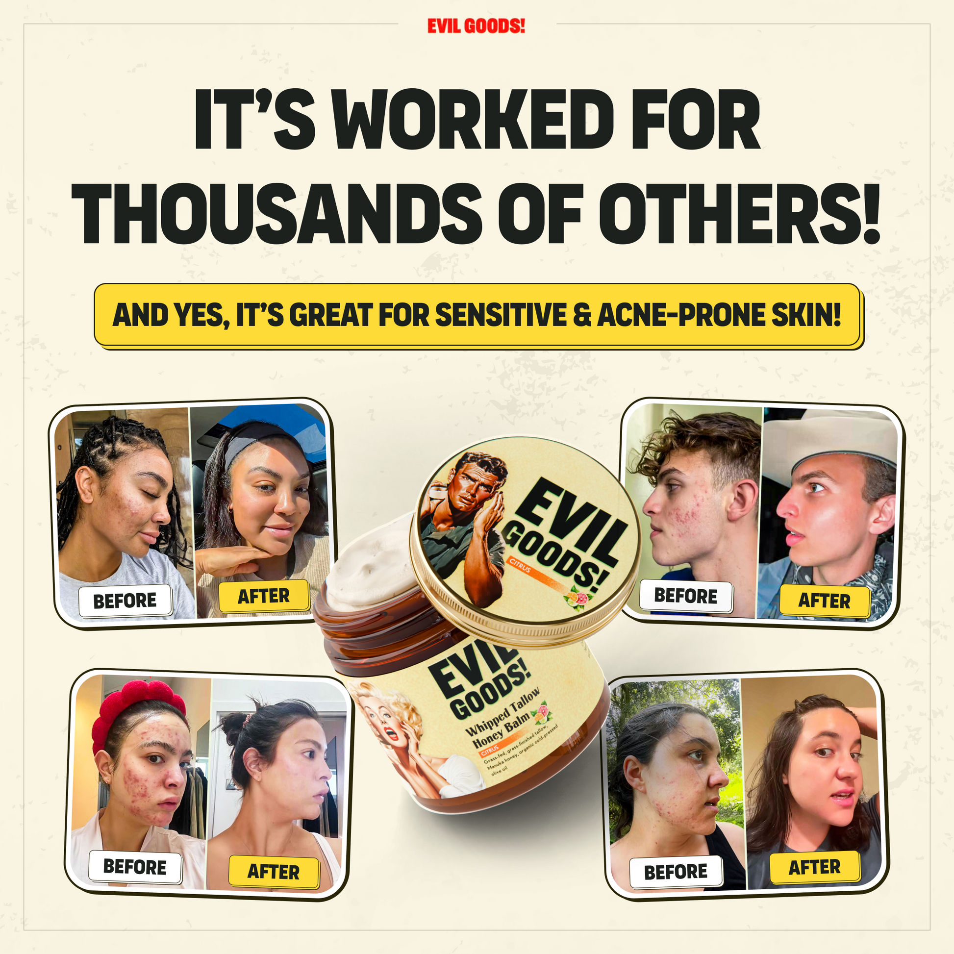 Whipped Tallow & Manuka Honey Moisturizer (V2) World’s Best Beef Tallow Balm